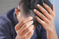 Je shampoo alleen redt je hoofdhuid niet meer